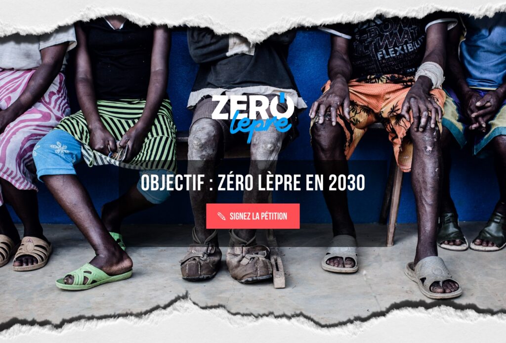 zero lepre social thumbnail
